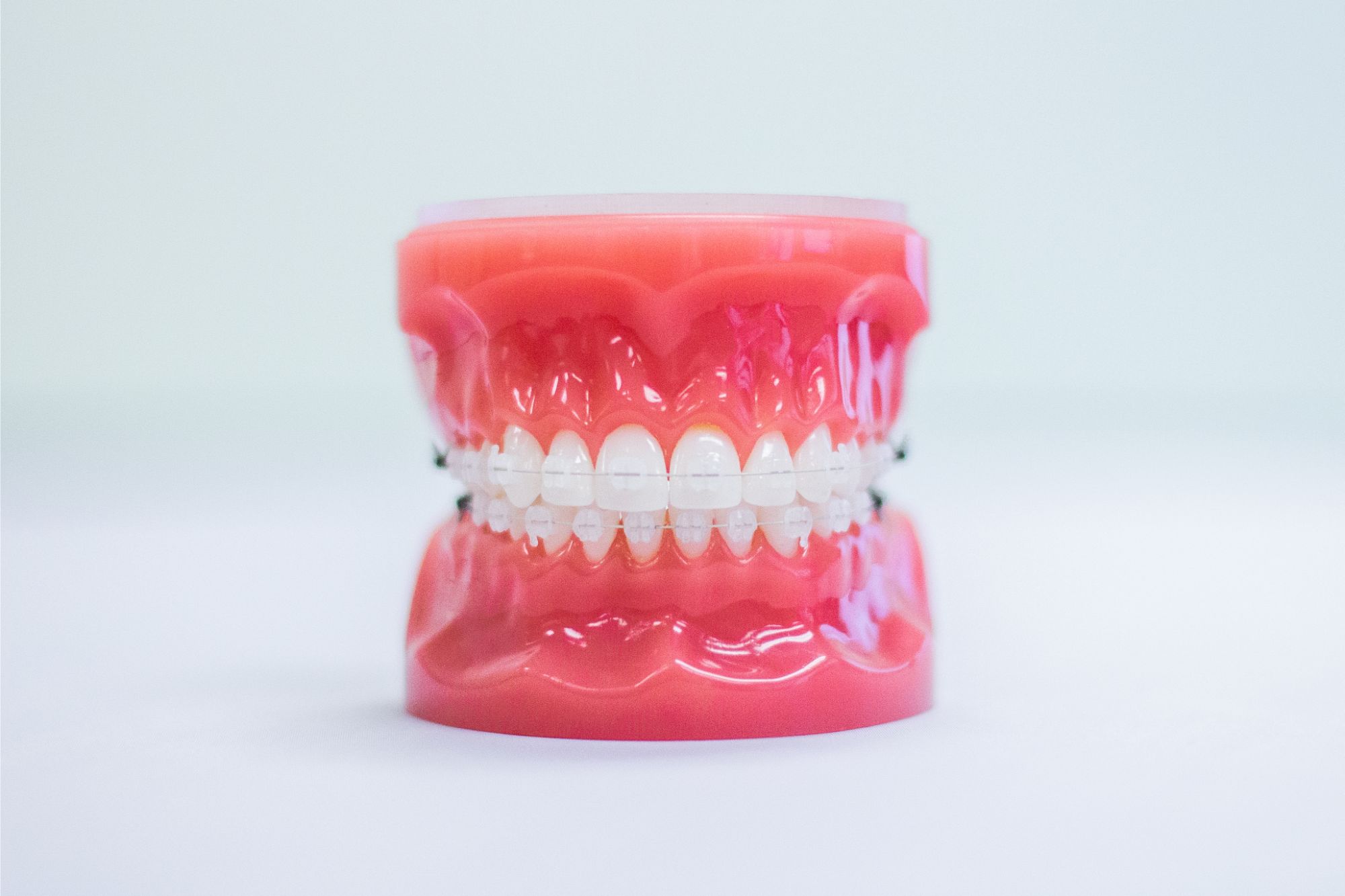 Model of clear ceramic braces offered as a braces option in Franklin TN at Cox Orthodontics